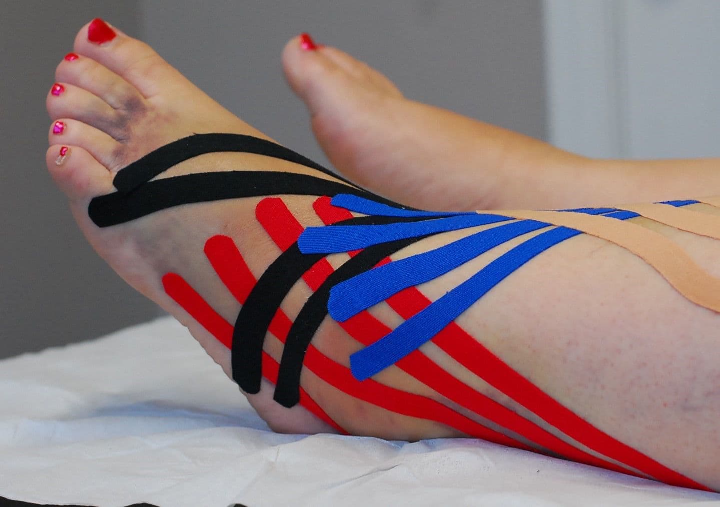 Kinesio Taping